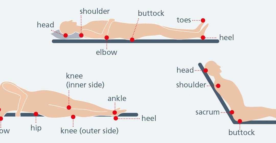 Pressure Area Care: What Every Care Worker Should Know